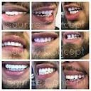 Sourire Concept